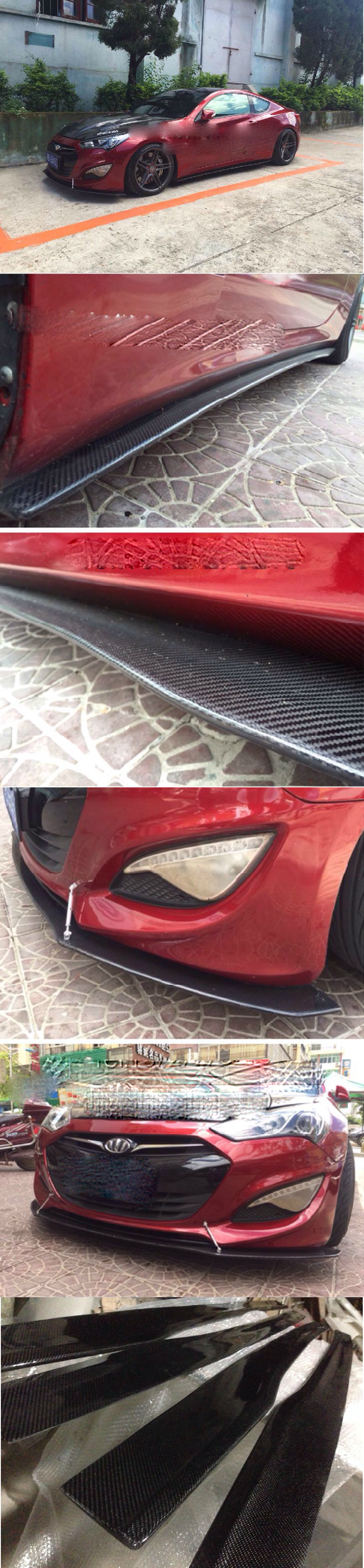 BỘ LIP TRƯỚC VÀ THÂN HAI BÊN CARBON GENESIS COUPE 2013-ON